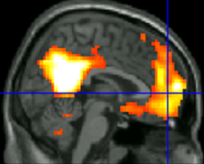 two brain regions where veterans trained in mindfulness saw the biggest increases in connections