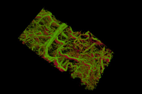 scientists develop new technique for imaging cells and tissues under the skin