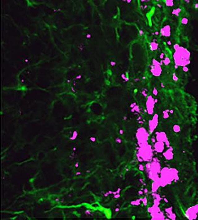 Skin Cells and Brain Cancer Cells