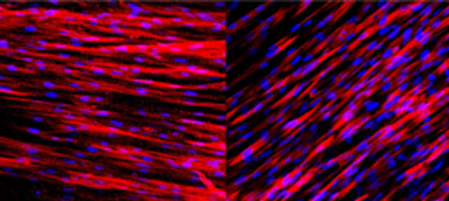 Artificial Artery Slide Stain