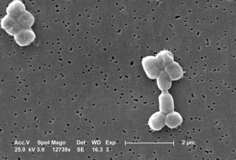 Acinetobacter baumannii bacteria 