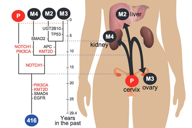 DNA sequencing demonstrated how cancer evolved