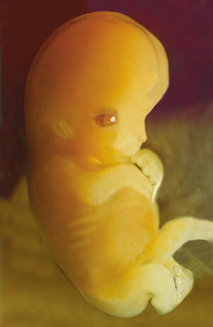 human embryo