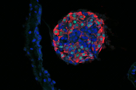 Stem cell-derived, glucose-stimulated, insulin-producing cells