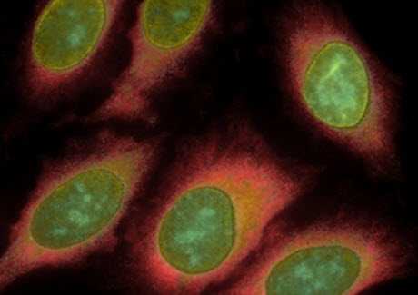 A composite image of HeLa cells stained sequentially with antibodies to five different proteins