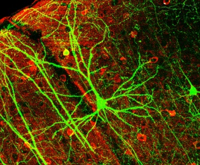 pyramidal neuron