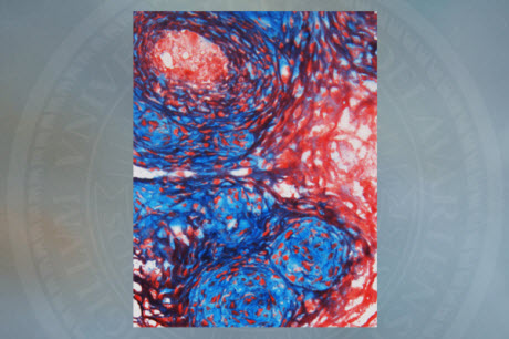 interactions between fibrous tissue (red) and nonfibrous microdomains (blue)