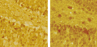 Newly discovered windows of brain plasticity may help with treatment of stress-related disorders