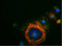 CTCs characterization using ViewRNA for multiplex in situ RNA analysis