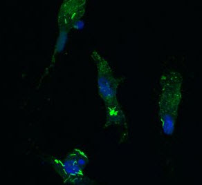 Tuberculosis bacteria (bright green) that have hijacked the white blood cells of a macaque monkey