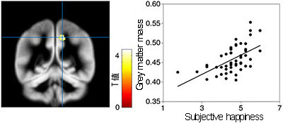 The correlation between the right precuneus and subjective happiness