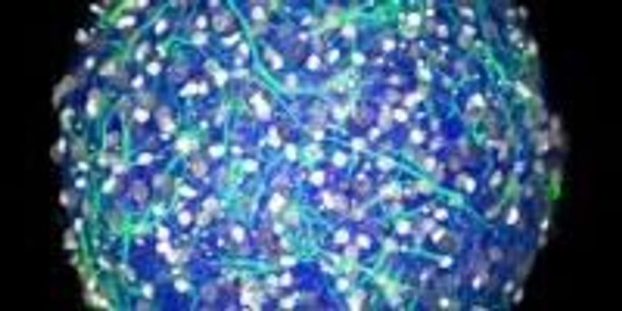 An Accessible Approach to Making a Mini-Brain | Lab Manager
