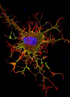 a fibroblast,