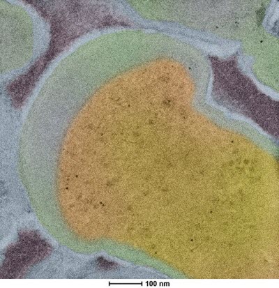 colorized image of a thin section of Bacillus subtilis