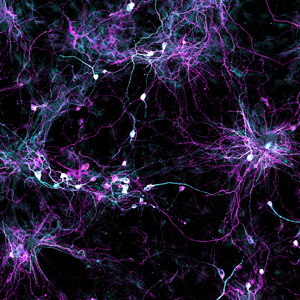 Researchers learn how to grow old brain cells