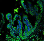 Lab-Grown 3-D Intestine Regenerates Gut Lining in Dogs