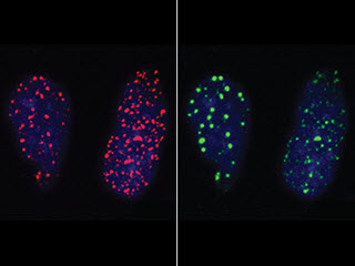 New findings shed light on fundamental process of DNA repair