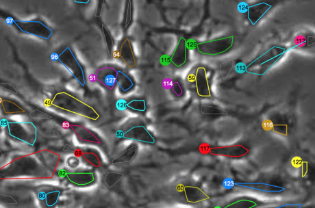 computational image analysis programs developed at Drexel
