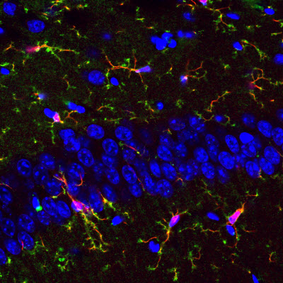 microglia