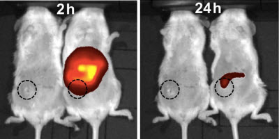 nanoparticles and tumors