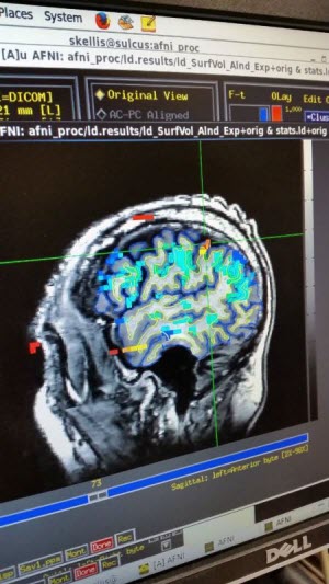 fMRI scan example