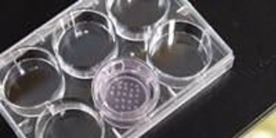 Mini Kidneys Grown from Stem Cells Give New Insights into Kidney ...