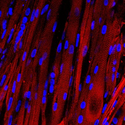 lab-grown human muscle