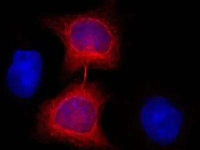 Nanobodies