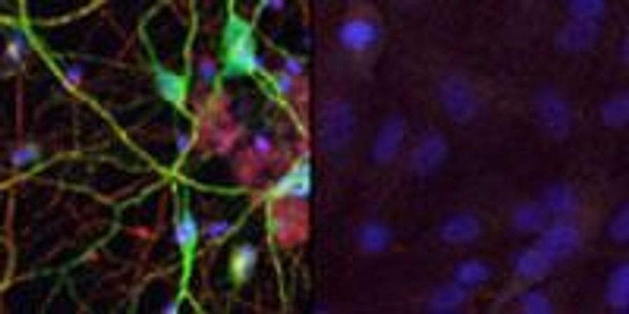 Human Skin Cells Reprogrammed Directly into Brain Cells | Lab Manager