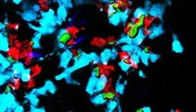 imaging the immune response