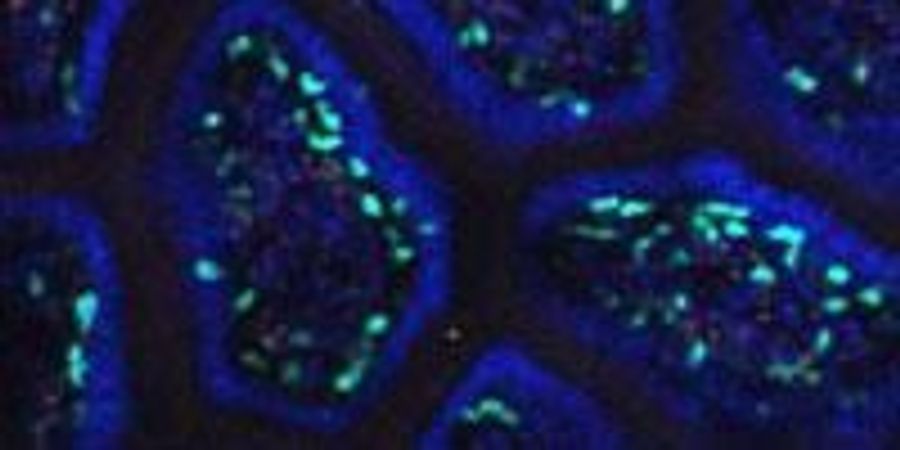 Research Explains how Cellular Guardians of the Gut Develop | Lab Manager