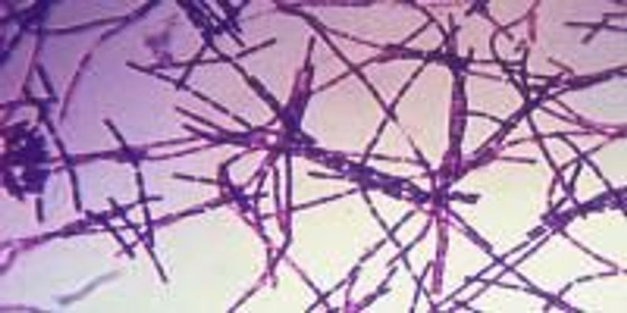 CDC Director Releases After-Action Report on Recent Anthrax Incident ...