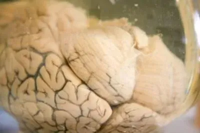 Brain
