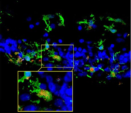 C3 Expression Occurs in Context of Photoreceptor Degeneration