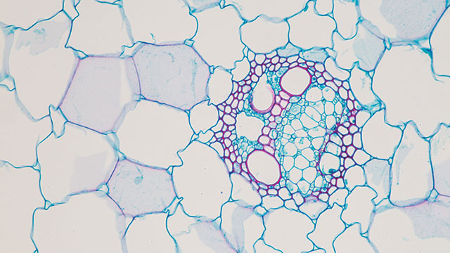 Optical Microscopy: Considerable Life in Centuries-Old Method | Lab Manager