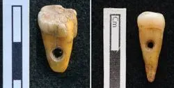Rare Find Human Teeth Used as Jewelry in Turkey 8,500 Years Ago