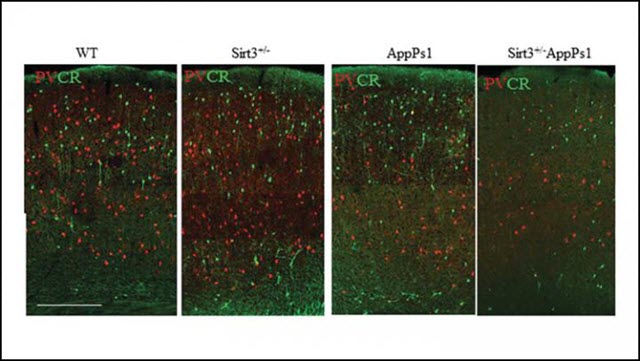 Eating More Ketones May Help Fight Alzheimer's Disease