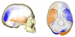 Human Endocast