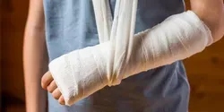 Broken Arm