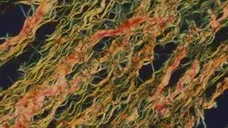 Identifying Collagen Fiber Types I and III High Color Rendering LED