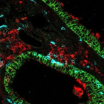 Lung-specific CD8 killer T cells (blue) in lung tissue 