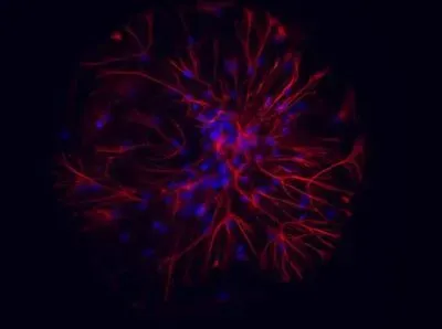 Colored Image of Neurons and Astrocytes