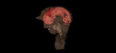 CT image of engineered rabbit uterus with fetus