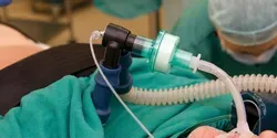 intubated COVID-19 patient