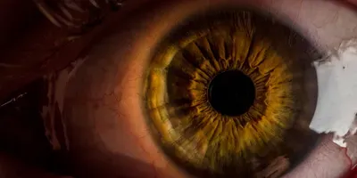 Close up image of a human eye. Eye color is golden brown and pupil is dilated and fearful in appearance, image is suggestive of how PTSD may affect the human eye