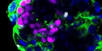 Image of a Human Embryo Cultured in Vitro