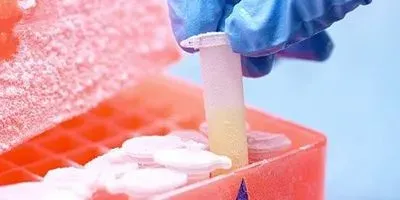 Optimized Freezing Solutions for Clinical Application of Cell Therapy Products