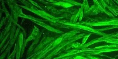 Skeletal muscle differentiation using Transcription Factor delivered as RNA