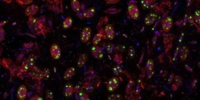 Visualization Method Provides Quantitative Number for Biomass—First Estimate of its Kind
