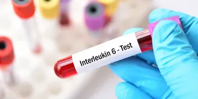 IL-6 Test Concept Image